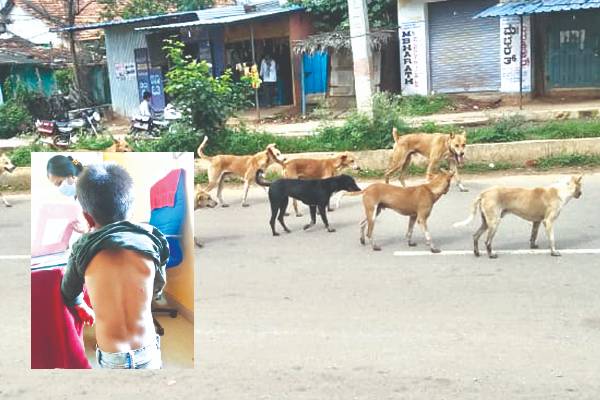 Nallur stray dog attack children