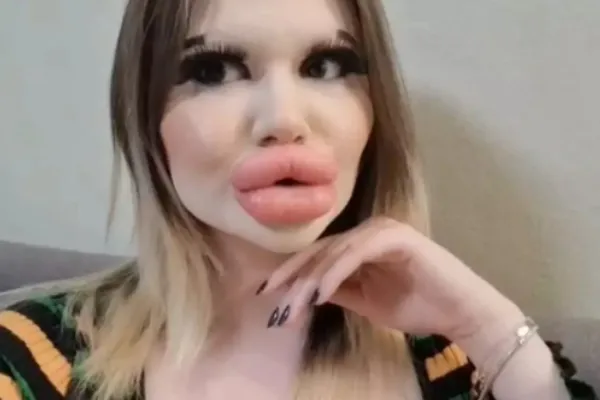 biggest lips woman