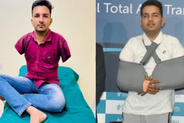 first Asian to undergo total arm transplant