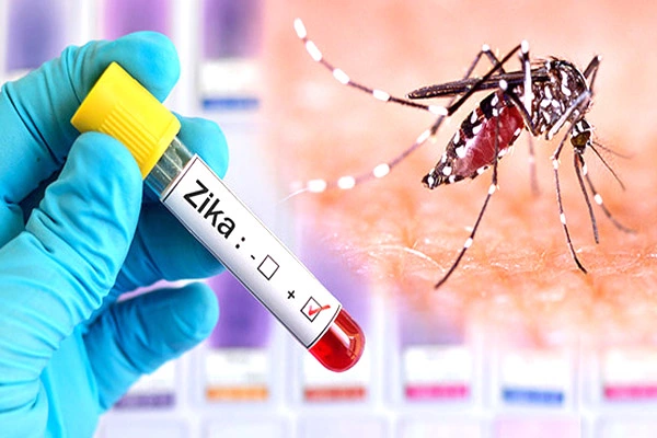 Zika Virus